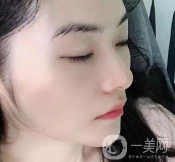 廣州南方醫(yī)院去眼袋費(fèi)用多少?2020整形價(jià)格表一覽