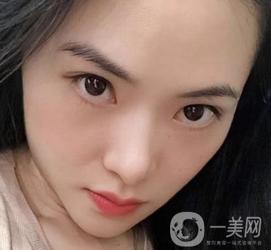 廣州南方醫(yī)院去眼袋費(fèi)用多少?2020整形價(jià)格表一覽