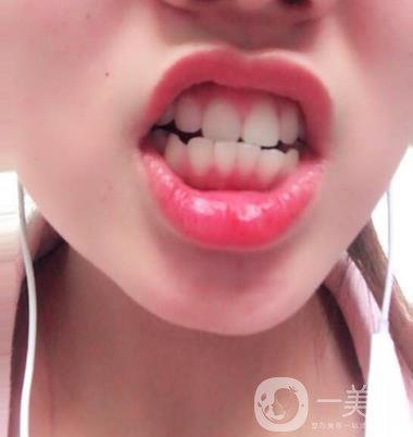 廣州曙光醫(yī)院整牙