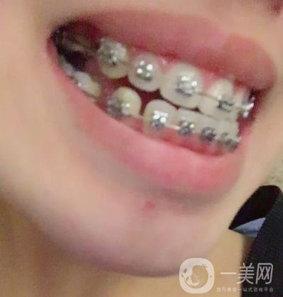 廣州曙光醫(yī)院整牙