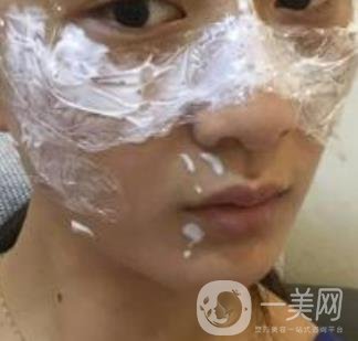青醫(yī)附院整形美容科價格表及祛斑案例公布，速覽