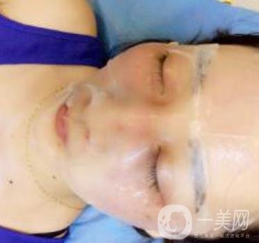青醫(yī)附院整形美容科價格表及祛斑案例公布，速覽