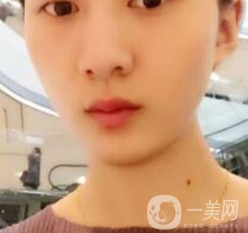青醫(yī)附院整形美容科價格表及祛斑案例公布，速覽