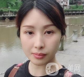 沈陽(yáng)軍區(qū)總醫(yī)院整形外科價(jià)格表，附雙眼皮真實(shí)案例