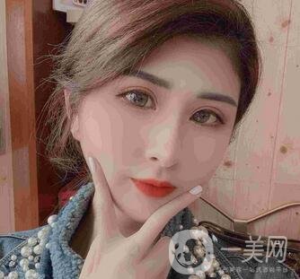 山西省整形外科醫(yī)院割雙眼皮怎么樣?案例價格表來襲