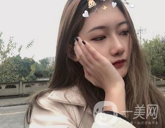 重慶新橋醫(yī)院整形科價(jià)格表，隆鼻案例分享