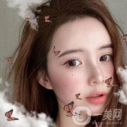 北京大學(xué)深圳醫(yī)院整形外科價格表，附雙眼皮案例