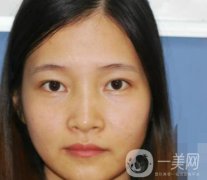 北京朝陽醫(yī)院整形中心紋眉果怎么樣？價格價目表詳情一覽