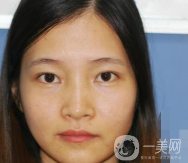 北京朝陽醫(yī)院整形中心紋眉*果怎么樣？價(jià)格價(jià)目表詳情一覽