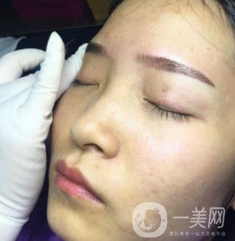 北京朝陽醫(yī)院整形中心紋眉*果怎么樣？價(jià)格價(jià)目表詳情一覽