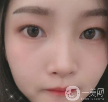 北京朝陽醫(yī)院整形中心紋眉*果怎么樣？價(jià)格價(jià)目表詳情一覽