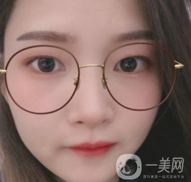 北京朝陽醫(yī)院整形中心紋眉*果怎么樣？價(jià)格價(jià)目表詳情一覽