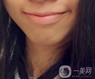復旦大學附屬兒科醫(yī)院口腔科做牙齒矯正多少錢？價格表明細一覽
