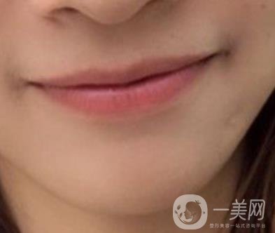 復旦大學附屬兒科醫(yī)院口腔科做牙齒矯正多少錢？價格表明細一覽