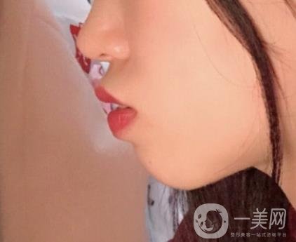 復旦大學附屬兒科醫(yī)院口腔科做牙齒矯正多少錢？價格表明細一覽