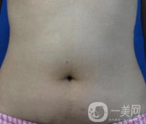 哈爾濱醫(yī)科大學(xué)附屬第一醫(yī)院整形科價格表和吸脂瘦肚子全新公布