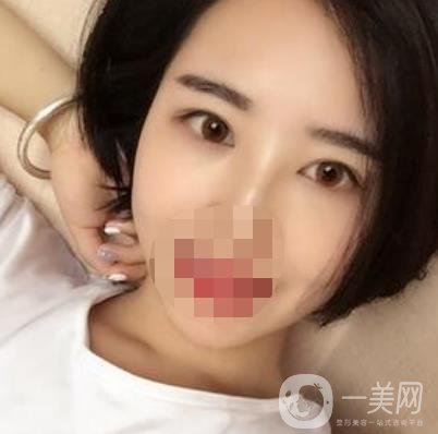 長(zhǎng)海醫(yī)院去眼袋