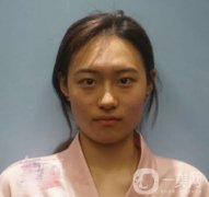 西京醫(yī)院整形美容科價格表，去眼袋手術(shù)恢復(fù)前后圖