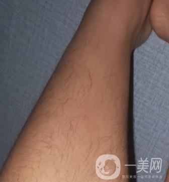 哈醫(yī)大四院整形美容科價(jià)格表鉅惠來襲，附冰點(diǎn)脫毛案例