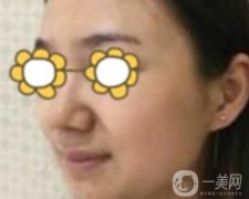 阜陽市人民醫(yī)院整形美容科價格表2020版，附*案例