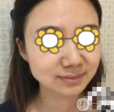 阜陽(yáng)市人民醫(yī)院整形美容科價(jià)格表2020版，附*案例