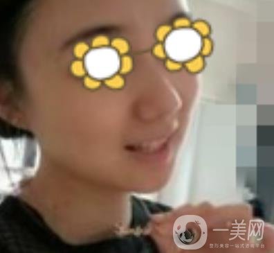 阜陽(yáng)市人民醫(yī)院整形美容科價(jià)格表2020版，附*案例