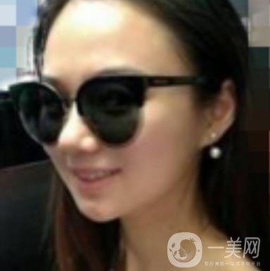 阜陽(yáng)市人民醫(yī)院整形美容科價(jià)格表2020版，附*案例