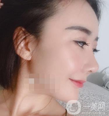 哈爾濱醫(yī)大二院整形美容科價(jià)格表上線，附*案例