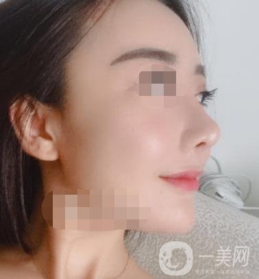 哈爾濱醫(yī)大二院整形美容科價(jià)格表上線，附*案例