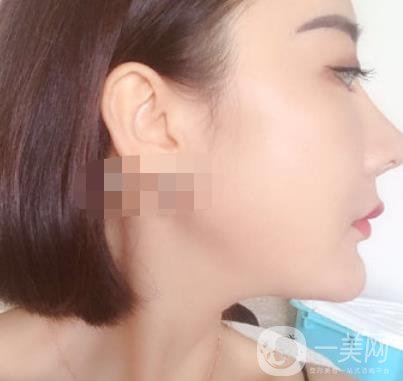 哈爾濱醫(yī)大二院整形美容科價(jià)格表上線，附*案例