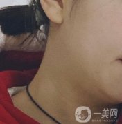 河南省人民醫(yī)院整形美容科價格表公布，附除腋臭案例