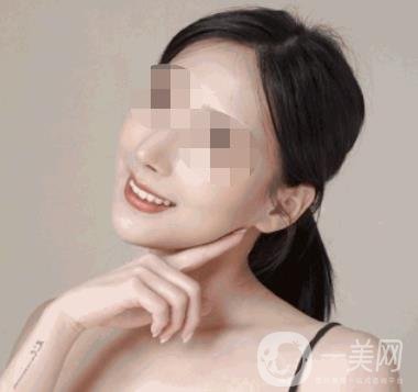 河南省人民醫(yī)院整形美容科價(jià)格表公布，附除腋臭案例