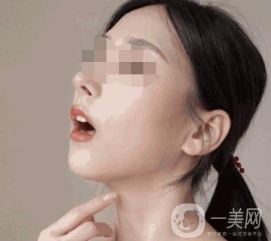 河南省人民醫(yī)院整形美容科價(jià)格表公布，附除腋臭案例