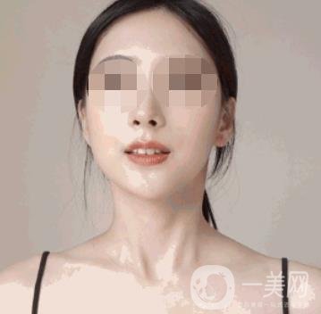 河南省人民醫(yī)院整形美容科價(jià)格表公布，附除腋臭案例