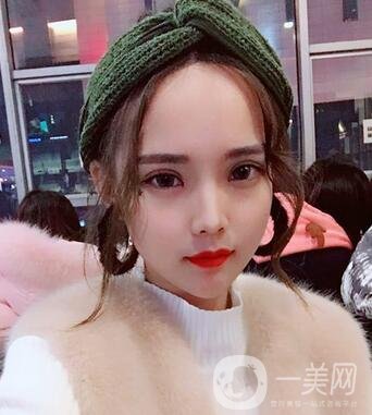 湖南第一醫(yī)院整形科價(jià)格表，附雙眼皮案例