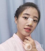 哈爾濱醫(yī)大二院美容科隆鼻果咋樣?附價(jià)格表一覽