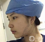 聊城市人民醫(yī)院整形科價格表及*案例一覽