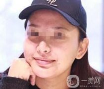 西南醫(yī)院*多少錢？附整形價格表及真實案例