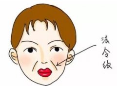 臉上出現(xiàn)法令紋顯老怎么辦？可以試試填充來解決凹陷