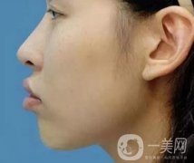 被“凸嘴!”封印的顏值，該如何解決？