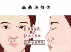玻尿酸注射鼻基底果如何?看專家詳解鼻基底的重要性