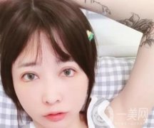 為什么不建議女性割這幾種形狀雙眼皮！看完文章你還要做嗎？