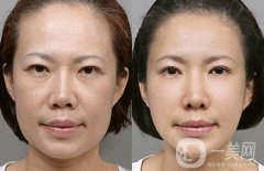 女明星都在做的熱瑪吉究竟有哪些果呢？原來(lái)抗初老全靠它