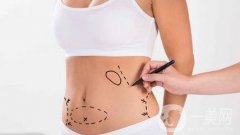 關(guān)于吸脂減肥的哪些事~*全解答介紹來(lái)了~