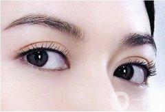 雙眼皮是埋線(xiàn)好還是全切好?雙眼皮手術(shù)方法有哪些?