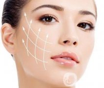 ACS面部提升技術怎么樣?主要針對哪些皺紋?