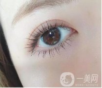 雙眼皮埋線和全切哪個自然?雙眼皮的形狀如何選擇?