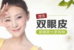 埋線雙眼皮多少錢?埋線雙眼皮有什么特點(diǎn)?