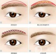 切眉術(shù)和提眉術(shù)有什么不同?區(qū)別具體是什么