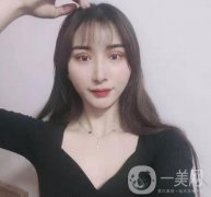 處楊明勇做雙眼皮怎么樣？專家案例_價(jià)格（價(jià)目）收費(fèi)反饋~